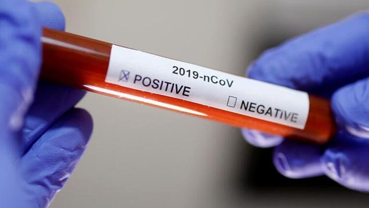 Korona virüs karantinasından kaçtı